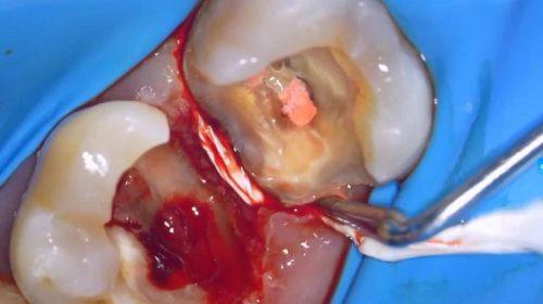 胡馨方医生口碑评价