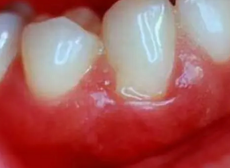 六、预防大于治疗,从根源减少孩子遭罪