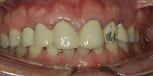 厦门登特口腔医院(莲花分店)擅长项目：