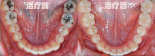 四川成都青羊牙多乐口腔连锁医生名单及擅长领域：