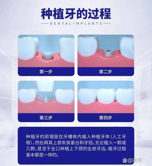 孙凯旋医生技术优势