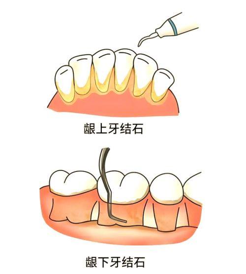 孙海燕医生技术优势
