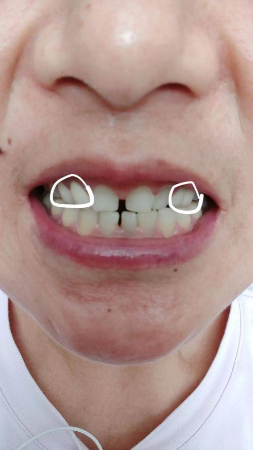 田晨医生怎么预约