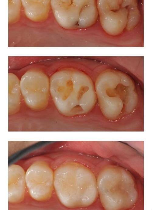 温州牙博士口腔（永嘉店）地址电话及营业时间：