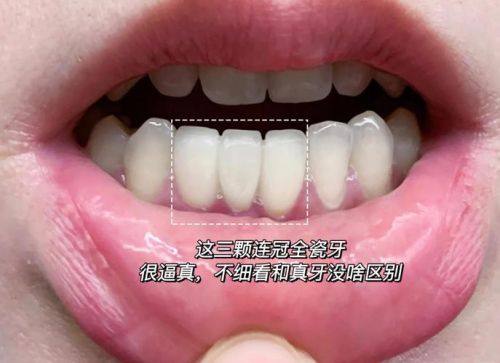 常德凡仕口腔预约挂号方式：