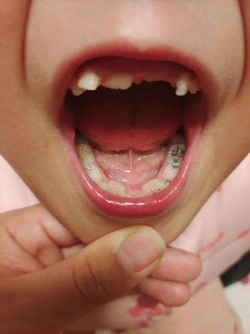 常德凡仕口腔擅长项目：