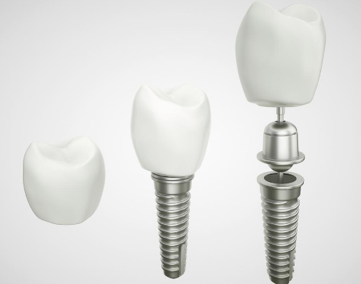 二、根管治疗的常规间隔参考：7-10天是普遍标准