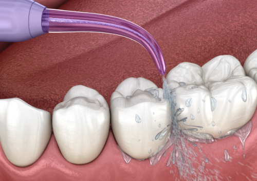湖南怀化沅陵湘信口腔地址电话及营业时间：