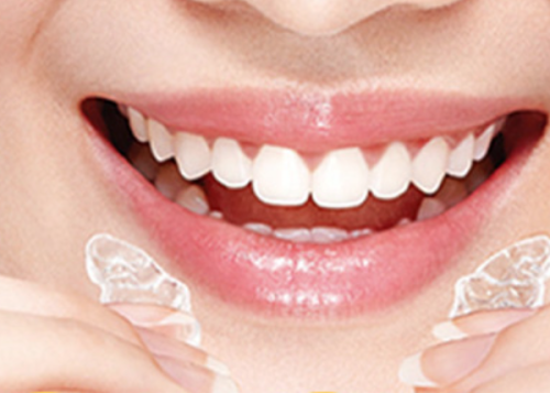 三、这些情况，做牙冠前必须先做根管治疗