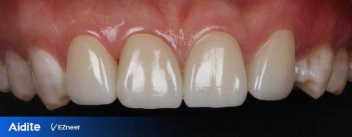 浙江金华永康雅尔口腔价格表：