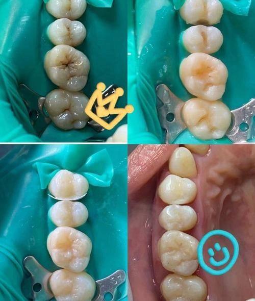 北京雅德嘉口腔(世纪城分院)怎么样？