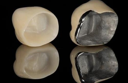 四、低压100如何才能拔牙？这些准备不能少