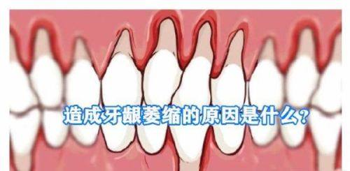 二、补牙能用社保卡里的钱吗