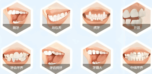 三、补牙齿可以用社保卡报销吗