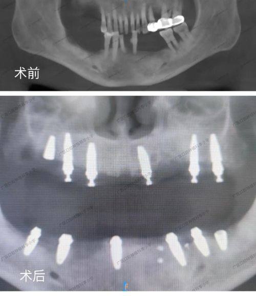 徐州熊猫竹子口腔医院医生名单及擅长领域