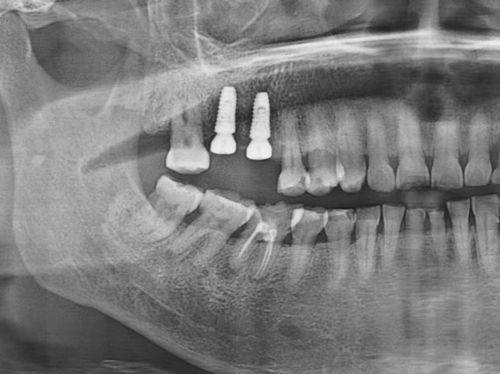 徐州熊猫竹子口腔医院怎么样？