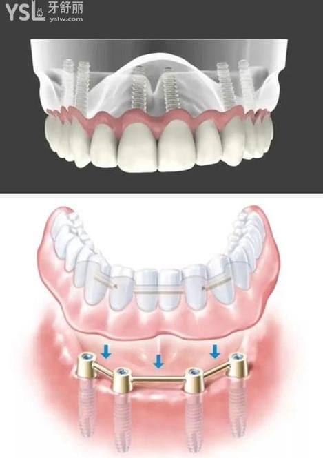 曹怀远医生技术优势