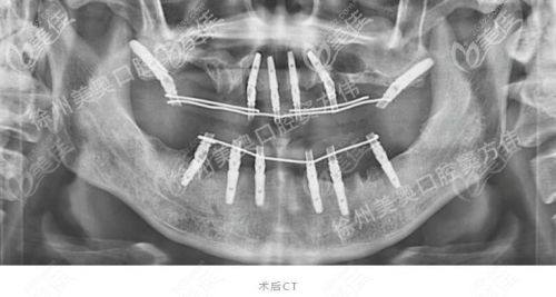 阿依加玛丽医生技术优势