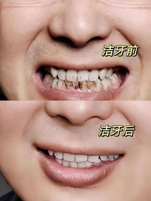 浙江衢州可恩口腔连锁价格表：