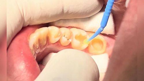 江苏常州宁悦口腔门诊部预约挂号方式