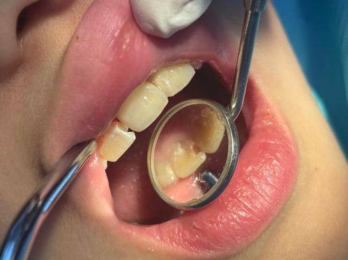 浙江衢州可恩口腔连锁地址电话及营业时间：