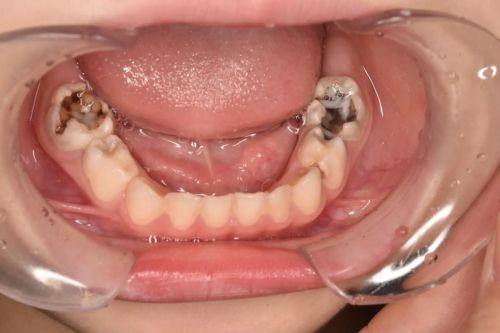 浙江衢州可恩口腔连锁口碑评价：