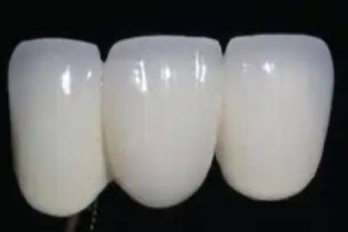 3岁孩子蛀牙需要补牙吗？解析必要性、补牙费用及日常护牙实用要点