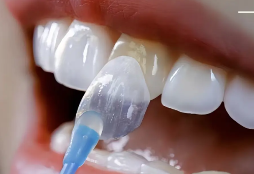 四、31岁做牙齿矫正的利弊分析