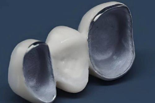 三、洗牙粉怎么用?真的能替代日常清洁吗