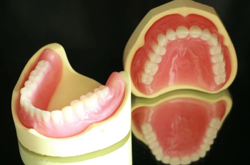 三、需要拔除牙根后开展种植牙的情况