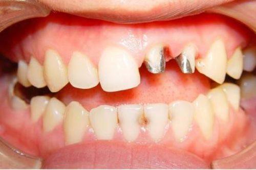 湖州长兴众城口腔口碑评价