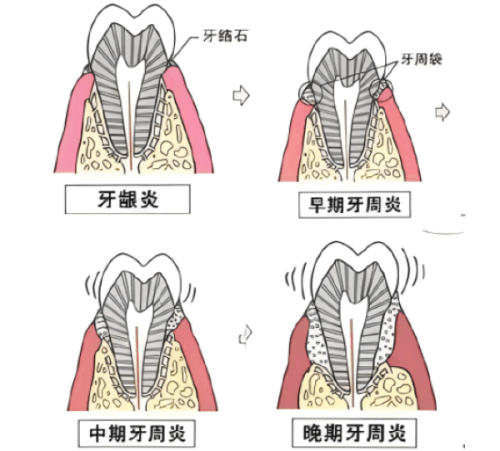 三、进口品牌二氧化锆全瓷牙硬度数据一览