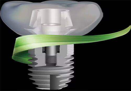 开封植得口腔医院擅长项目: