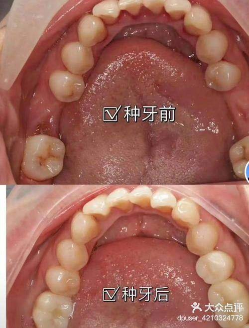 开封植得口腔医院怎么样?