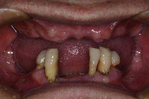 开封植得口腔医院口碑评价: