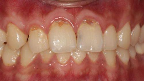 张艳芳医生擅长领域: