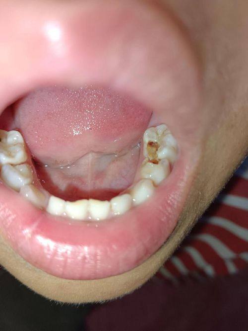 湖州长兴众城口腔怎么样