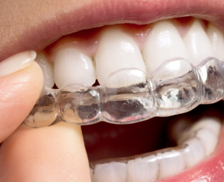 五、种植牙修复的实用细节解析