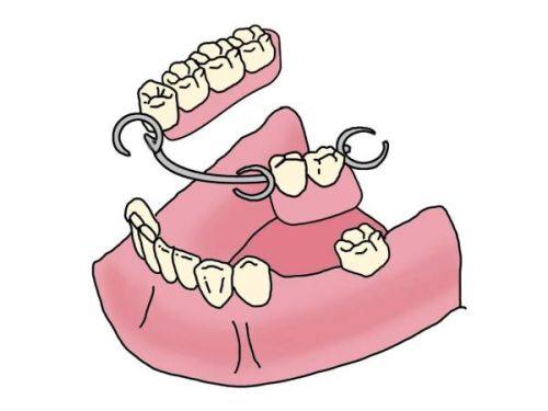 六、影响高端烤瓷牙价格的核心因素