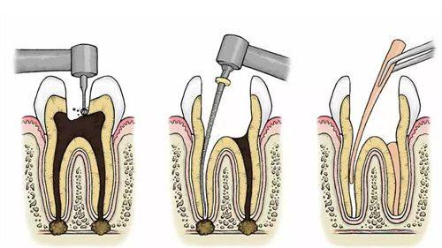 张艳芳医生怎么预约