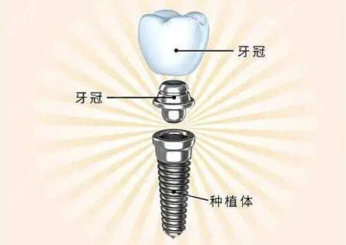 郝晓娟医生技术优势：