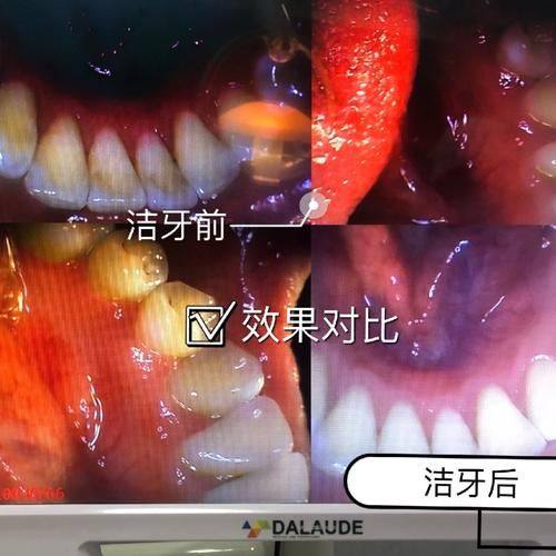 山东临沂兰山惠娟口腔价格表