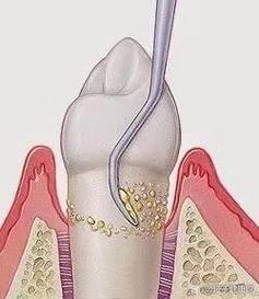 东莞市臻美口腔门诊怎么样？