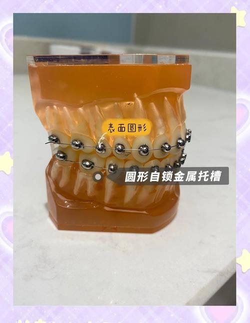 东莞市臻美口腔门诊价格表：