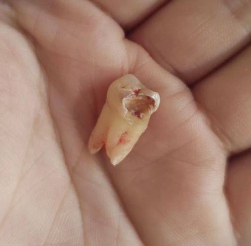 广东广州麦特登口腔口碑评价：