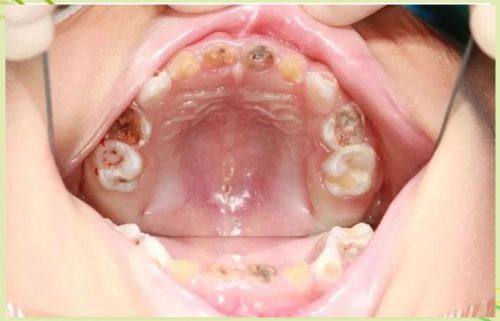 厦门宝金惠民门诊部口腔科医生名单及擅长领域：