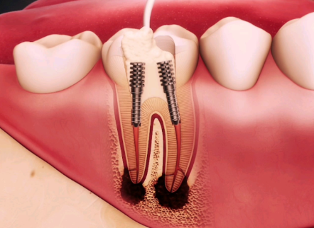 汕头护牙乐口腔科诊所预约挂号方式