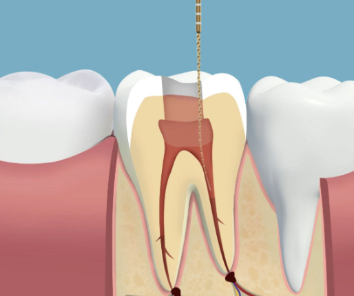 张艳芳医生口碑评价