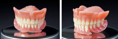 二、不同拔牙场景下的出血修复时长差异