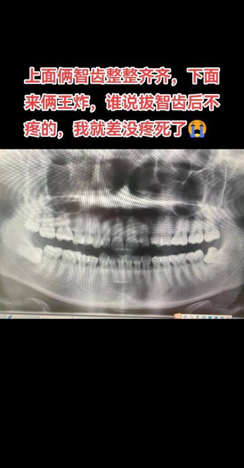 山东潍坊青州蒋福志口腔预约挂号方式